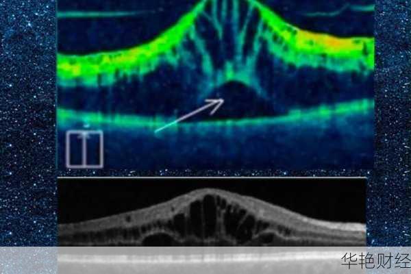 外汇OCT指标是什么意思？老手教你看懂盘面！