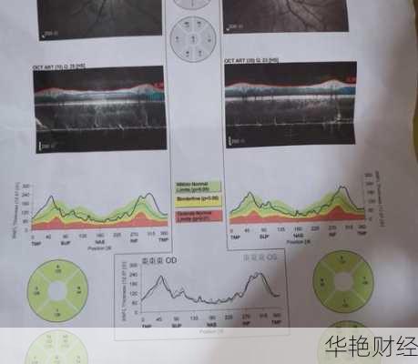 oct外汇是什么意思;外汇auc是什么意思